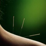 Les secrets de l'acupuncture pour une peau éclatante et saine